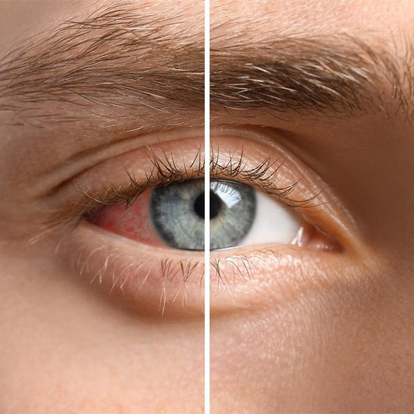 Clear Eyes® Redness Relief, 3-pack - ClearEyesKungen